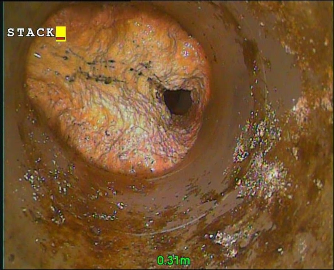 CCTV still inside a soil stack, a thick crust of uric scale closing the bore down to a small opening at 0.31 metres.